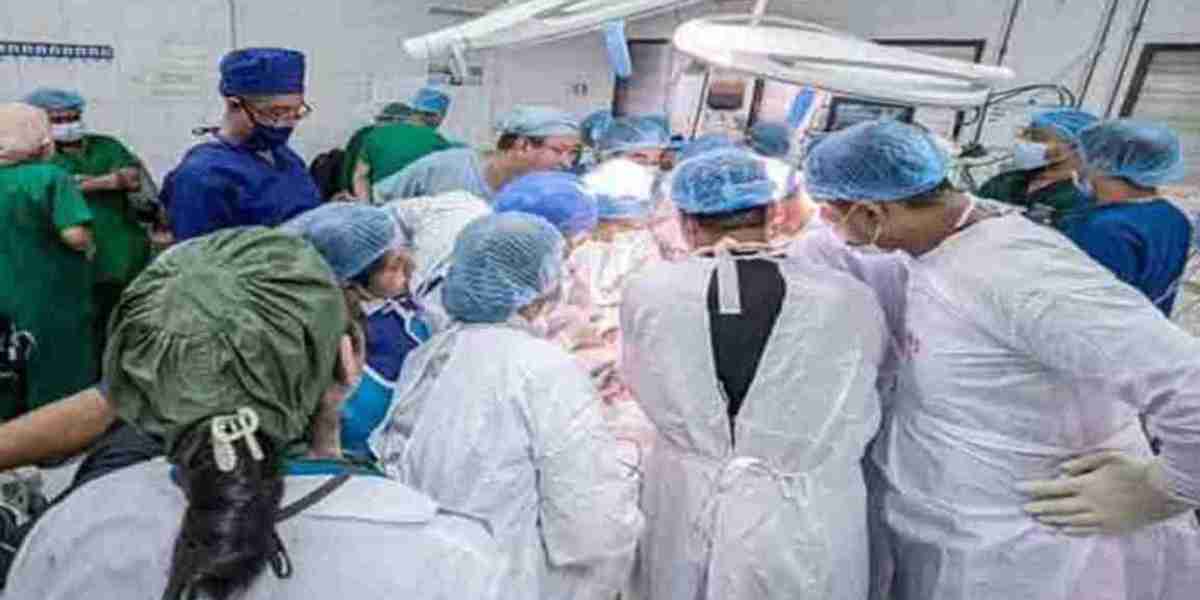 After 10 hours of efforts of 80 doctors, the twins were separated