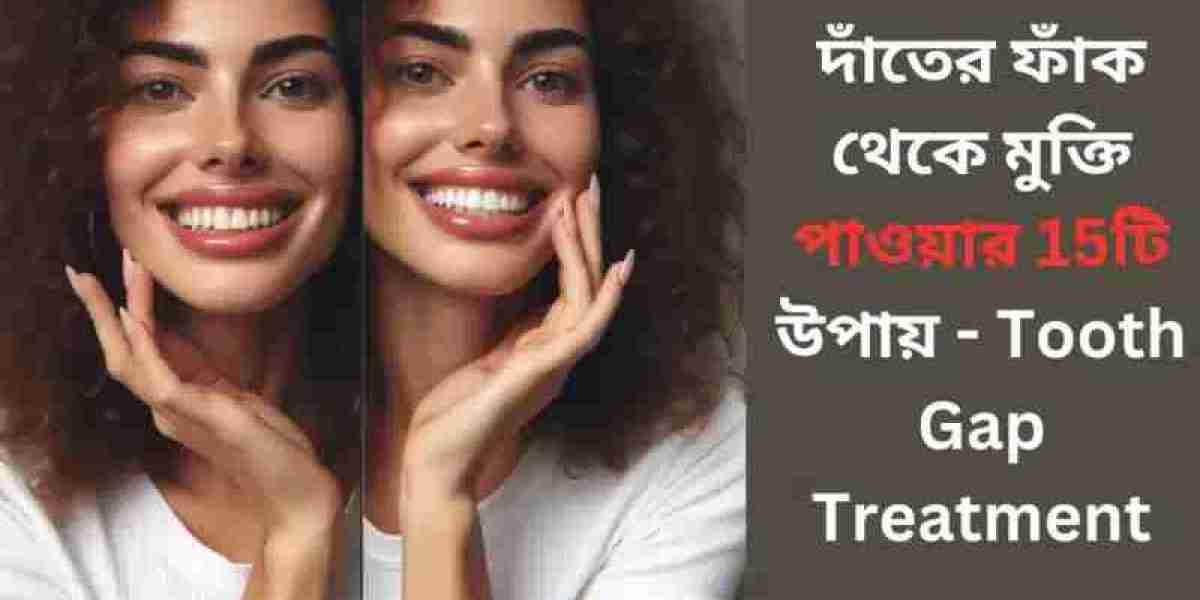 দাঁতের ফাঁক থেকে মুক্তি পাওয়ার 15টি উপায় – Tooth Gap Treatment