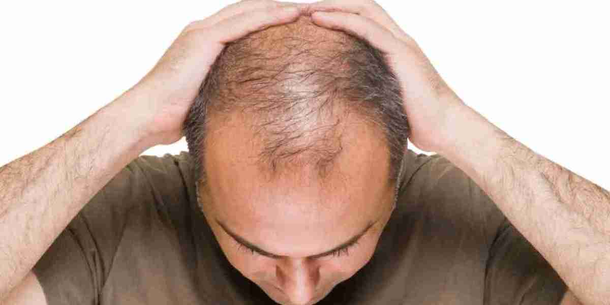 What are the causes of baldness, how to prevent it