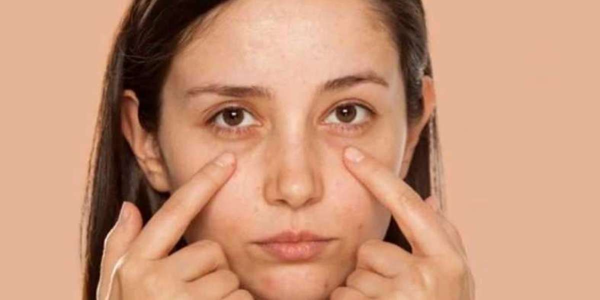 Why is swelling under the eyes?