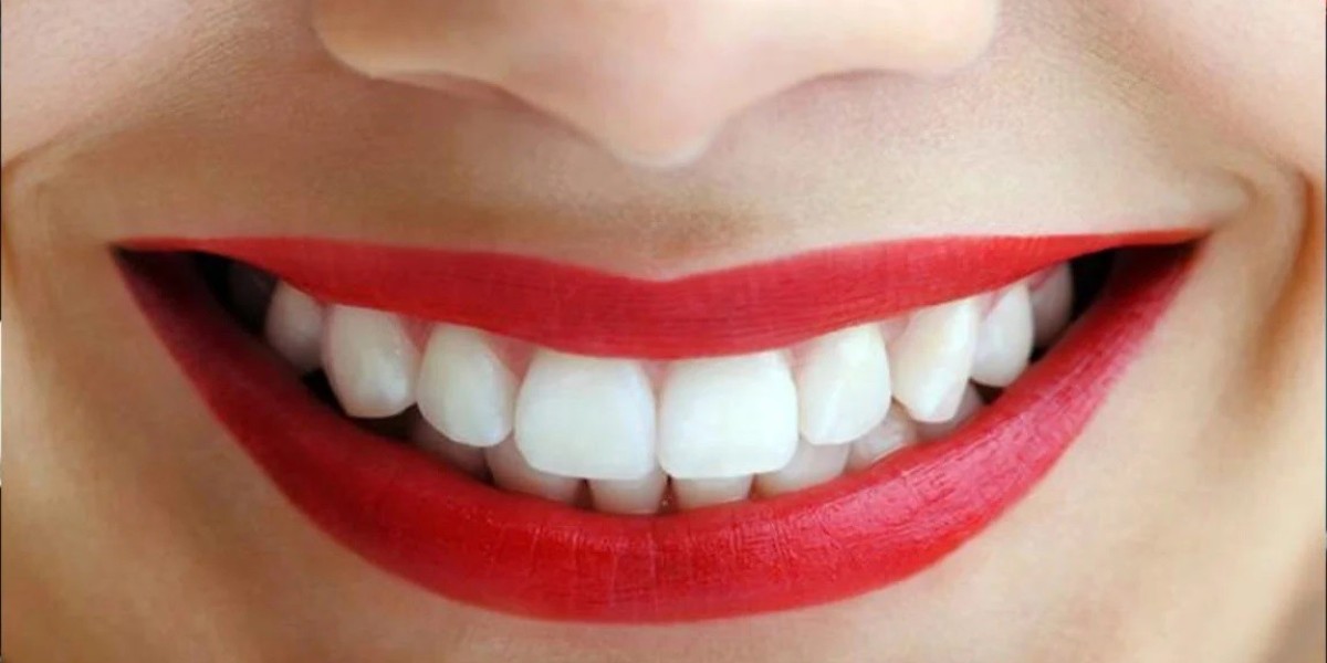 Home remedies are great ways to whiten teeth