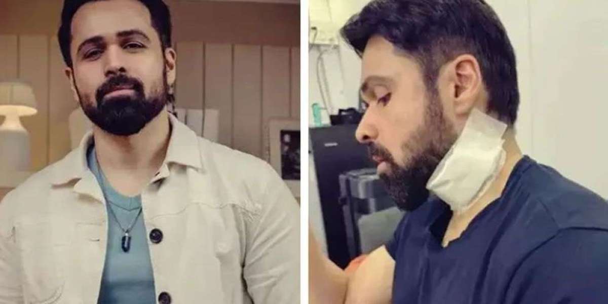 Emraan Hashmir is bleeding from under the jaw